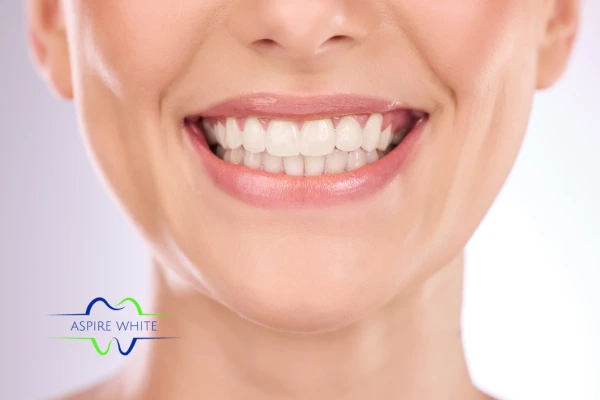 Follow your teeth whitening aftercare Warrington to prolong your whiter smile!